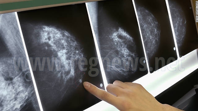 ДКЦ I във Велико Търново предлага мамографско изследване на половин цена 