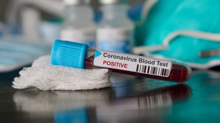Двама с COVID-19 са настанени в Горнооряховската болница, още един заразен има във Велико Търново